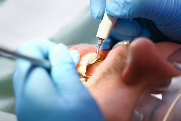 Best Cracked Tooth Emergency Dentist  in Guntersville, AL