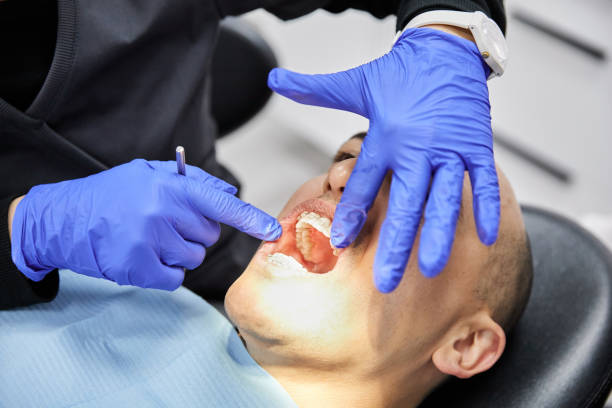 Best Dentist for Tooth Abscess  in Guntersville, AL
